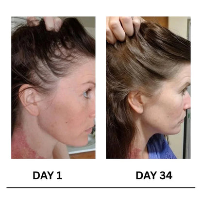 Scalpy Boost+ Hair Growth